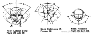 Schemas of 3 heads with resp. arcs of circles: - neck lateral bend Right (A) and Left (B) - Neck extension (AB) and flexion (B) - Neck rotation Right (A) and Left (B)